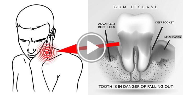 natural gum health video