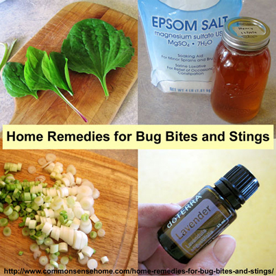 14 Home Remedies For Bug Bites And Stings
