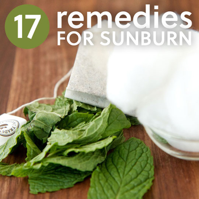 17 Home Remedies For Sunburn
