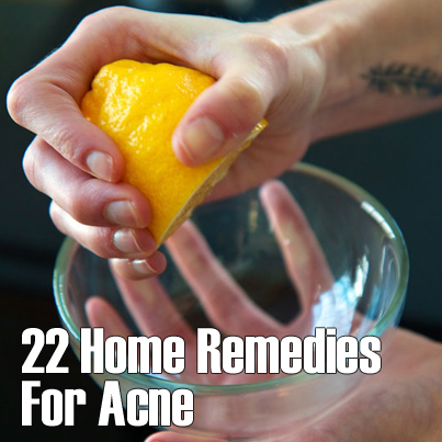 22 Home Remedies For Acne
