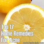 Top 17 Home Remedies for Acne