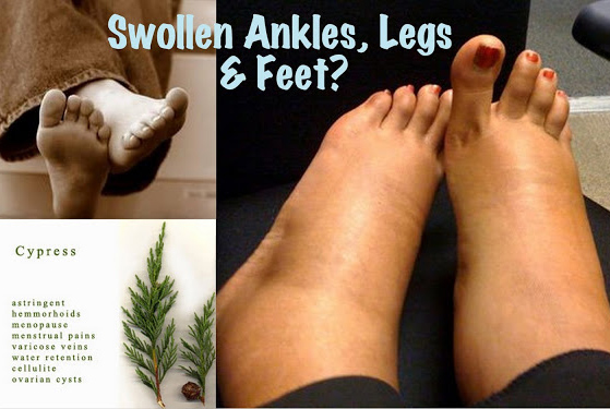 Essential Oils For Swollen Ankles, Legs and Feet
