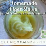 Homemade And Natural Stretch Marks Cream