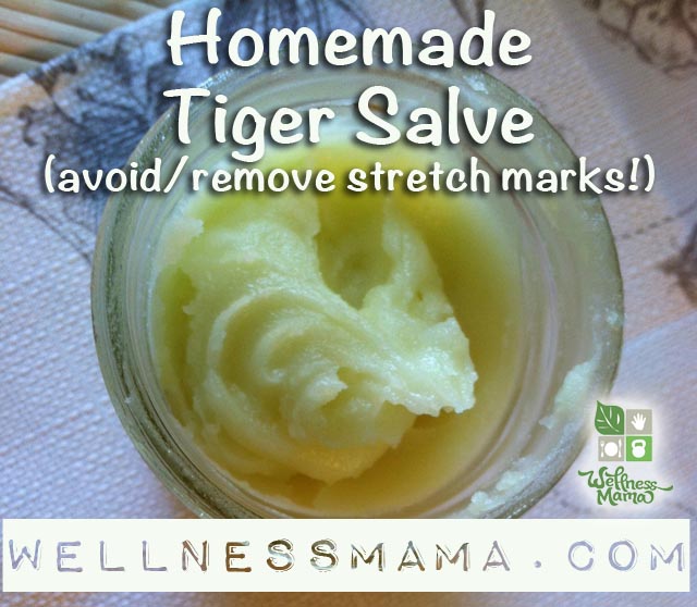 Homemade Natural Stretch Marks Cream