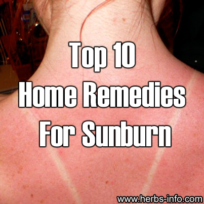 Top 10 Home Remedies For Sunburn
