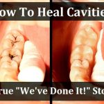 How To Heal Cavities: The Astonishing Claims Of The Oil Pullers