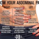 Know Your Abdominal Pain (Chart)