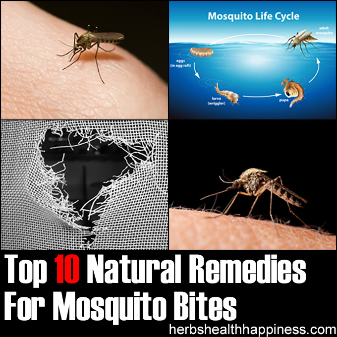 Top 10 Natural Remedies For Mosquito Bites