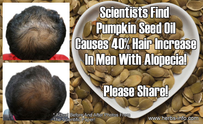 Scientists Find Pumpkin Seed Oil Causes 40 Percent Hair Increase In Men With Alopecia