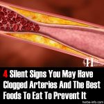 4 Silent Signs You May Have Clogged Arteries And The Best Foods To Eat To Prevent It