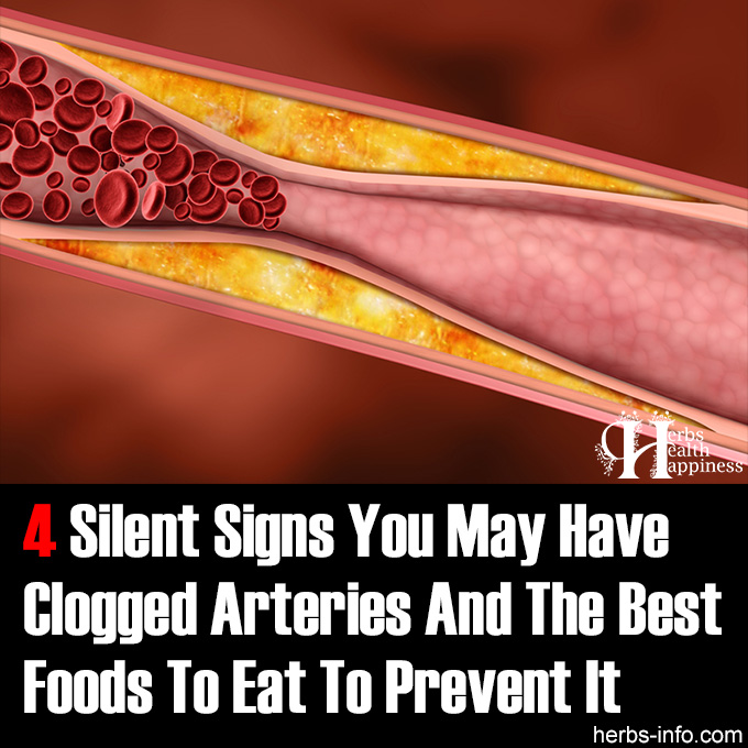 4 Silent Signs You May Have Clogged Arteries And The Best Foods To Eat To Prevent It