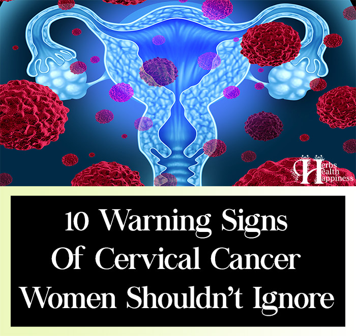 10 Warning Signs Of Cervical Cancer Women Shouldn’t Ignore