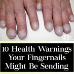 10 Health Warnings Your Fingernails May Be Sending