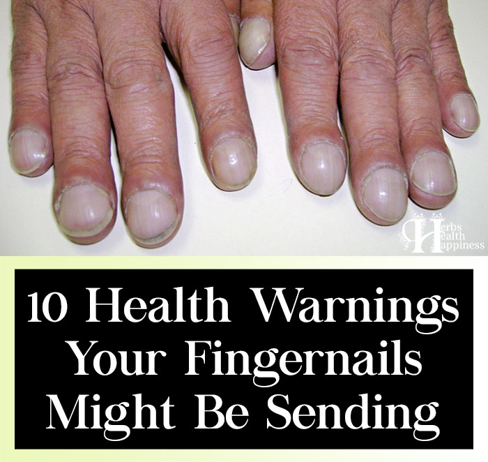 10 Health Warnings Your Fingernails Might Be Sending