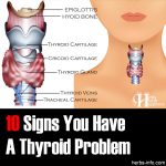 10 Signs You May Have A Thyroid Problem (And 10 Things You Can Do About It)
