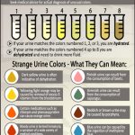 Are You Hydrated? Strange Urine Colors And Their Meaning