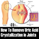 How To Remove Uric Acid Crystallization In Joints