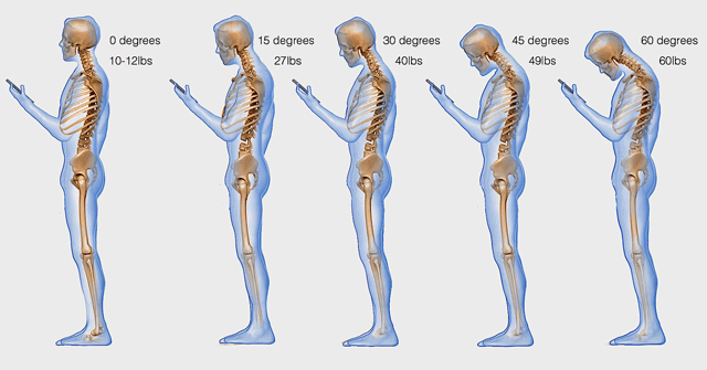 neck-pain-smartphoneWP-FB