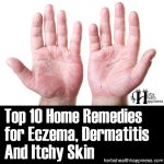 Top 10 Home Remedies For Eczema, Dermatitis And Itchy Skin