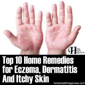 Top 10 Home Remedies For Eczema, Dermatitis And Itchy Skin - Herbs ...