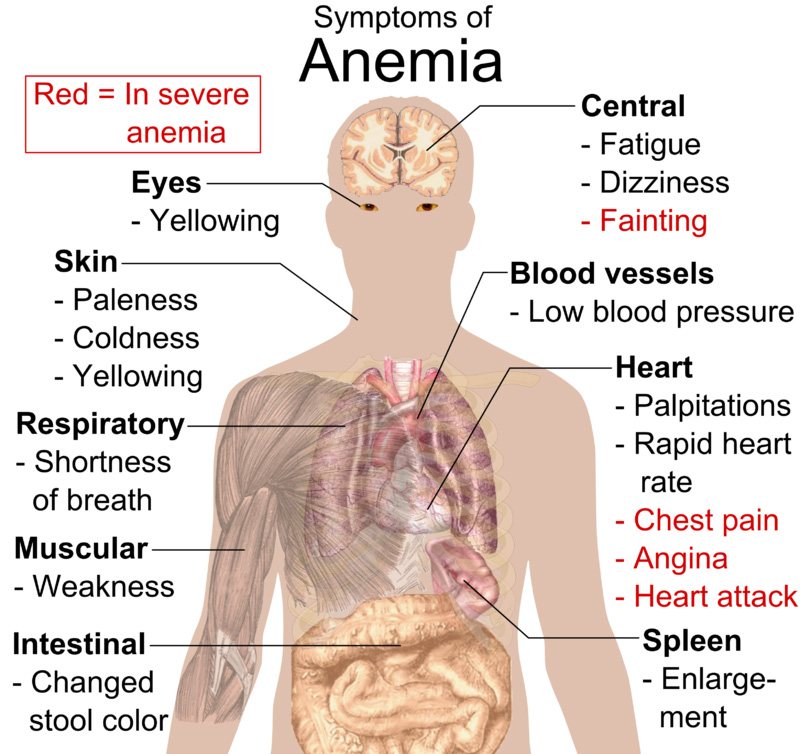 15 Foods To Fight Anemia