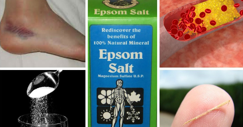 20 Mind Blowing Reasons Why Epsom Salt Should Be In Every Home