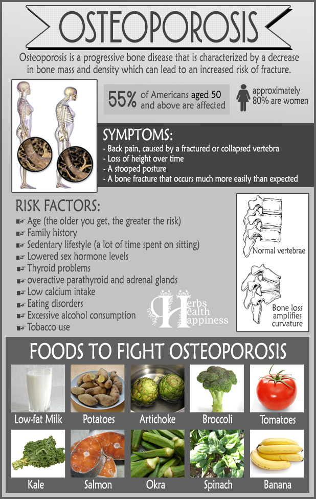 10 Things Putting You At Risk For Osteoporosis And What You Can Do About It