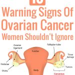 10 Warning Signs Of Ovarian Cancer Women Shouldn’t Ignore
