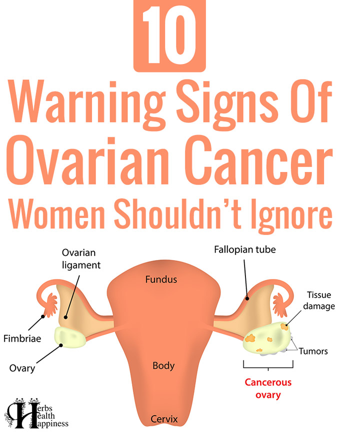10 Warning Signs Of Ovarian Cancer Women Shouldn’t Ignore