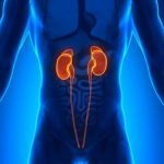 5 Natural Methods For Maintaining Kidney Health, Combating Sludge & Preventing Stones