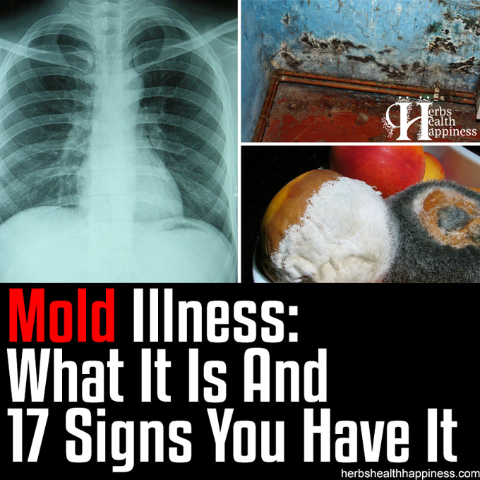 Mold Illness - What It Is And 17 Signs You Have It