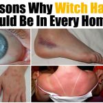 14 Reasons Why Witch Hazel Should Be In Every Home