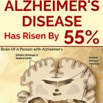 Death Rate From Alzheimer’s Disease Has Risen By 55%