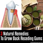 3 Natural Remedies To Grow Back Receding Gums