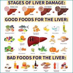 Fatty Liver Does Not Show Up In Scans Until It Is Too Late - Here Are 7 ...