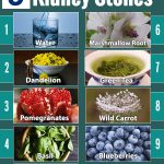 Top 9 Natural Remedies for Kidney Stones