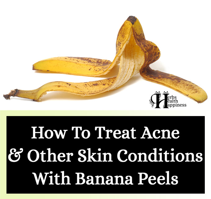How To Treat Acne And Other Skin Conditions With Banana Peels