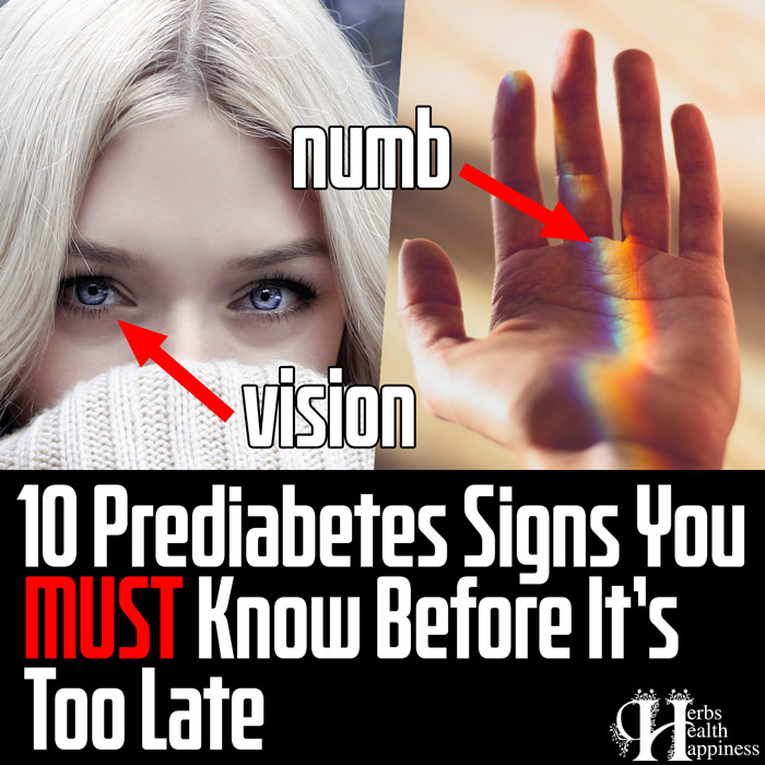 10 Prediabetes Signs You MUST Know Before It Is Too Late