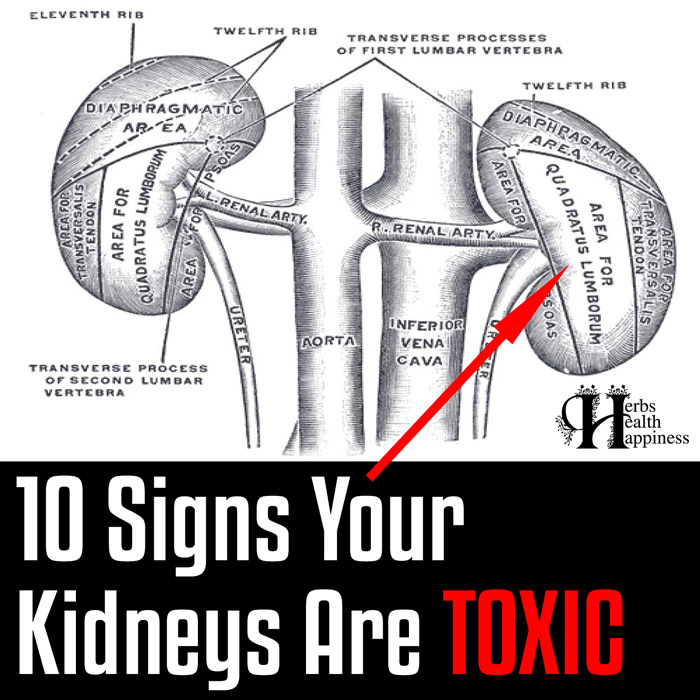 10 Signs Your Kidneys Are Toxic