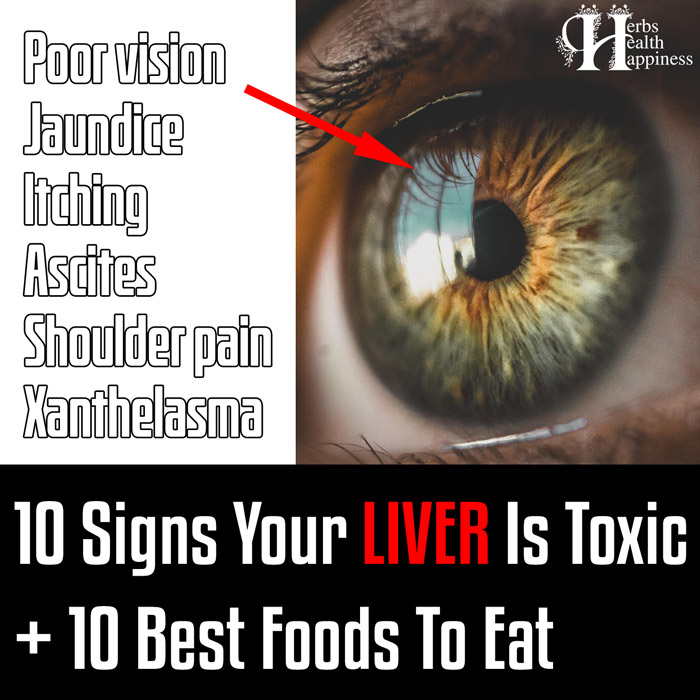 10 Warning Signs Your Liver Is Toxic + Top 10 Foods To Detox Your Liver