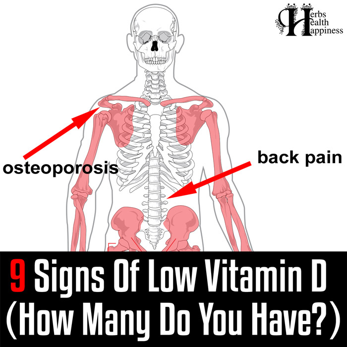 9 Signs Of Low Vitamin D (How Many Do You Have)