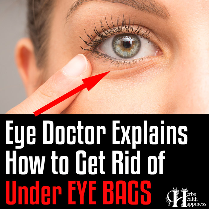 Eye Doctor Explains How to Get Rid of Under EYE BAGS