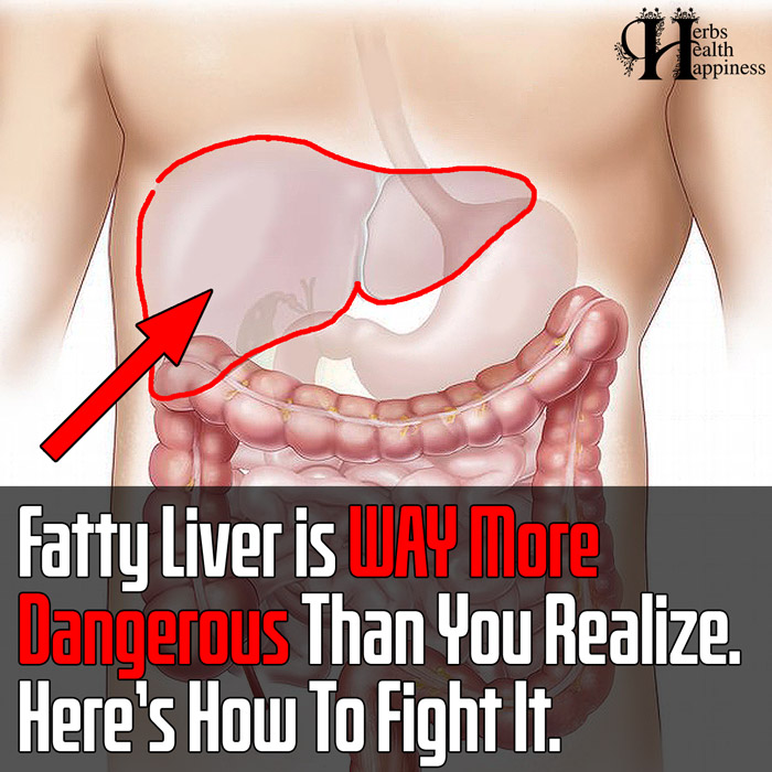 Fatty Liver is WAY More Dangerous Than You Realize