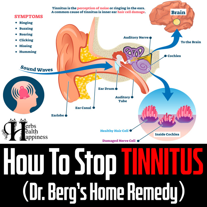 How To Stop Tinnitus - (Ringing In The Ears) – Try Dr.Berg's Home Remedy To Get Rid Of It