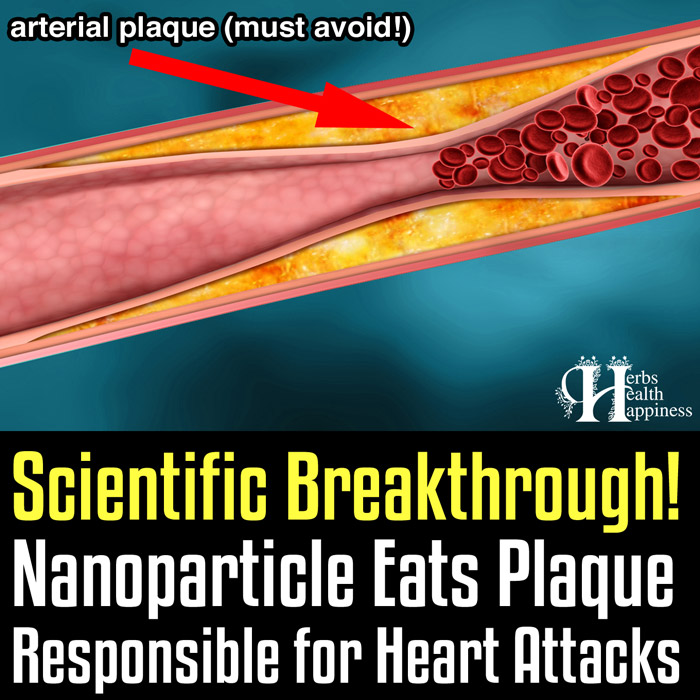 Scientific Breakthrough -  Nanoparticle Eats Plaque Responsible for Heart Attacks